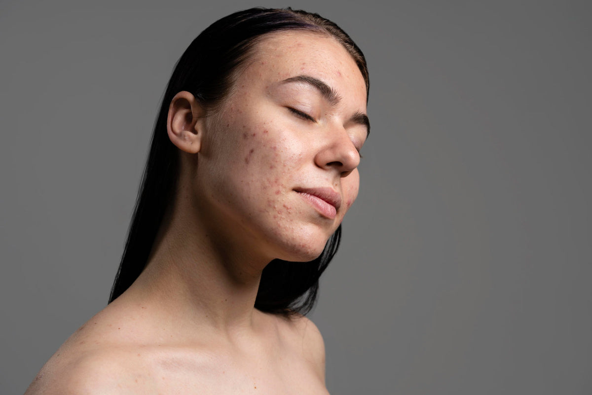 Why Does My Pigmentation Keep Coming Back?