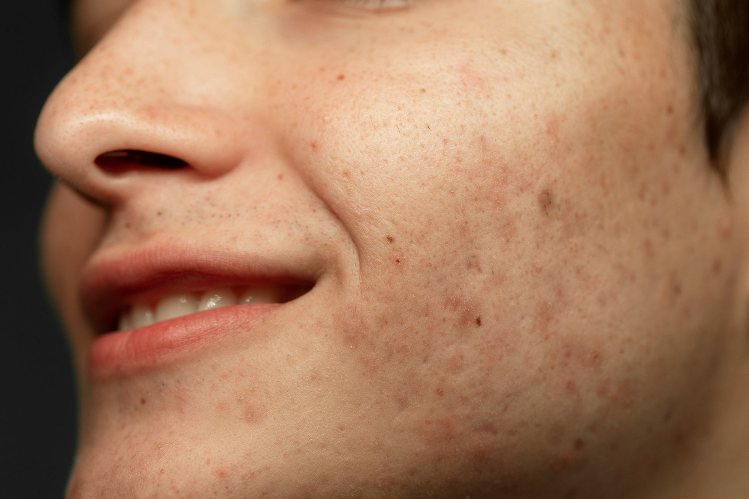 Combining Topicals, Supplements, and Professional Treatments for Stubborn Pigmentation
